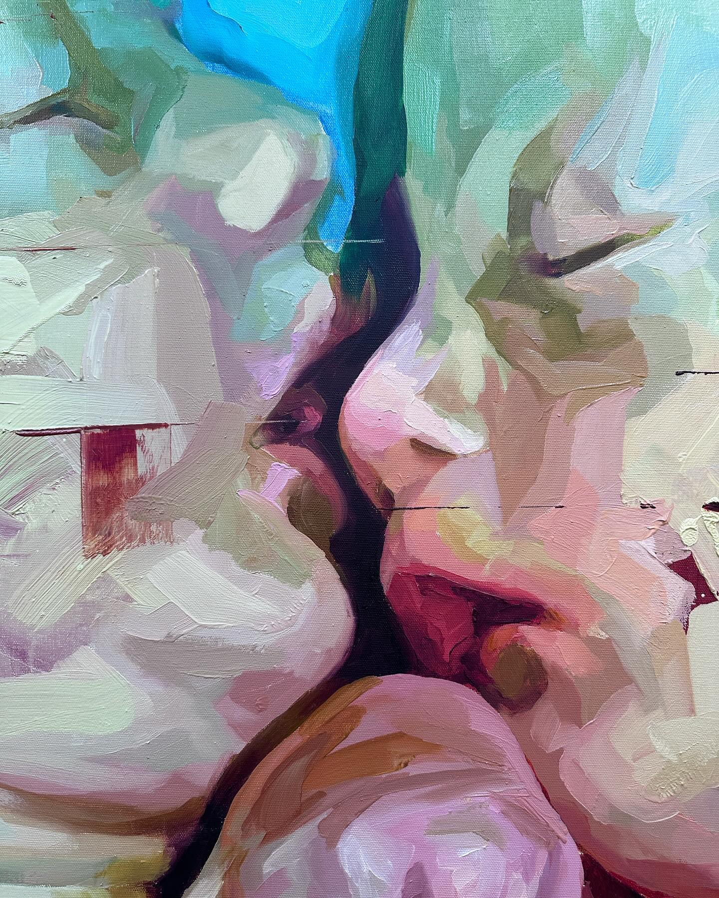 One Heart - One Love - Conjoined Twins by Justin Bower