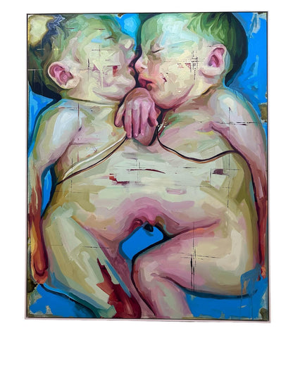 One Heart - One Love - Conjoined Twins by Justin Bower